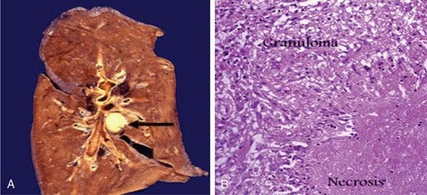 General Pathology