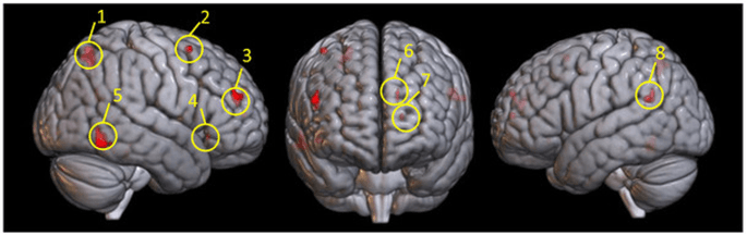 Neurology